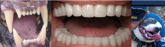 Tooth Human Herbivore