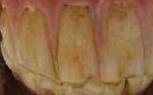 Whose teeth is this ?